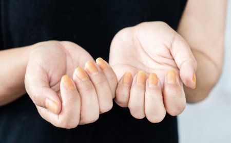 The Impact of Nail Health on Overall Wellness – What You Need to Know