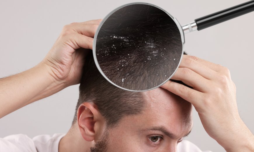Barbers Reveal Why Scalp Care Is a Game-Changer for Men