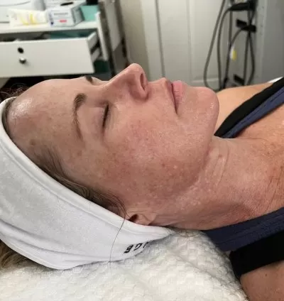 Pigmentation Correction