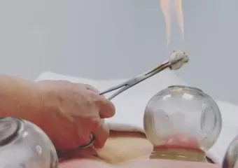 Azusa acupuncture and massage