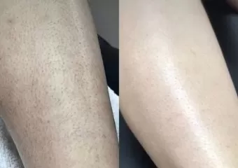 Derma Den Med Spa and Laser Clinic