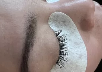 Dream Beauty esthetics and laser hair removal