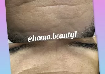 Homa beauty & Facial Spa(only women)