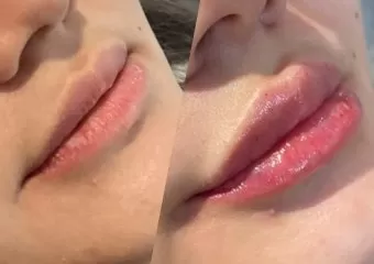 Raquel Aesthetic yyc