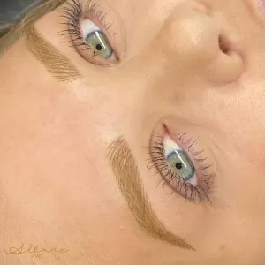 Allure YYC