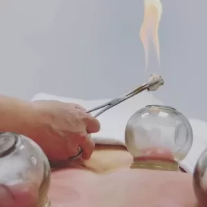 Azusa acupuncture and massage