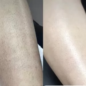 Derma Den Med Spa and Laser Clinic