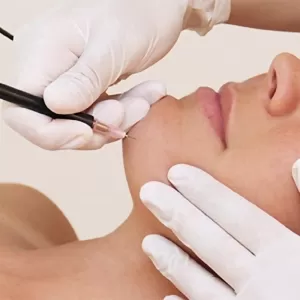 Samarpan Electrolysis Studio