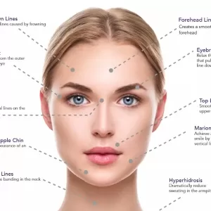 Totally Botox Calgary